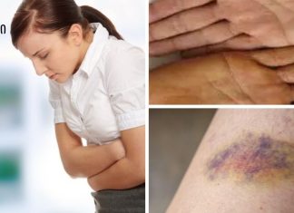 ყურადღება! პირველი 7 ნიშანი იმისა, რომ თქვენი ღვიძლი ძლიერ დაზიანებულია!