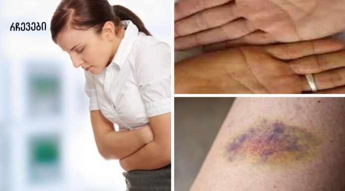 ყურადღება! პირველი 7 ნიშანი იმისა, რომ თქვენი ღვიძლი ძლიერ დაზიანებულია!