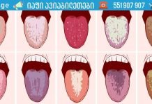 თუ დილით პირში ცუდი გემო გაქვთ, იმოქმედეთ ახლავე!