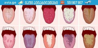 თუ დილით პირში ცუდი გემო გაქვთ, იმოქმედეთ ახლავე!