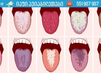 თუ დილით პირში ცუდი გემო გაქვთ, იმოქმედეთ ახლავე!