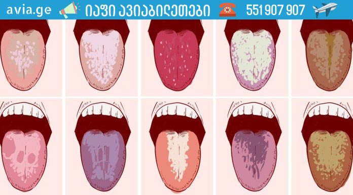 თუ დილით პირში ცუდი გემო გაქვთ, იმოქმედეთ ახლავე!