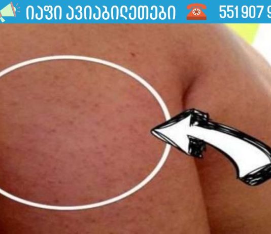 ყველაფერი რაც თქვენ უნდა იცოდეთ მკლავებზე, ბარძაყებსა და დუნდულოებზე გამაღიზიანებელი აკნეების შესახებ