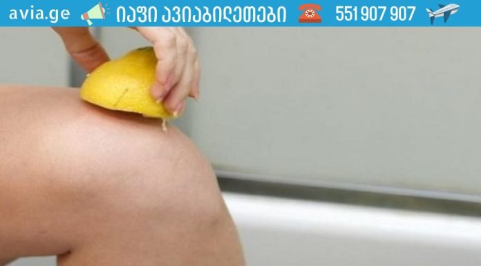 დღეში ერთი ლიმონი – და სახსრების ტკივილი გაქრება! რასაც ექიმები გვიმალავენ