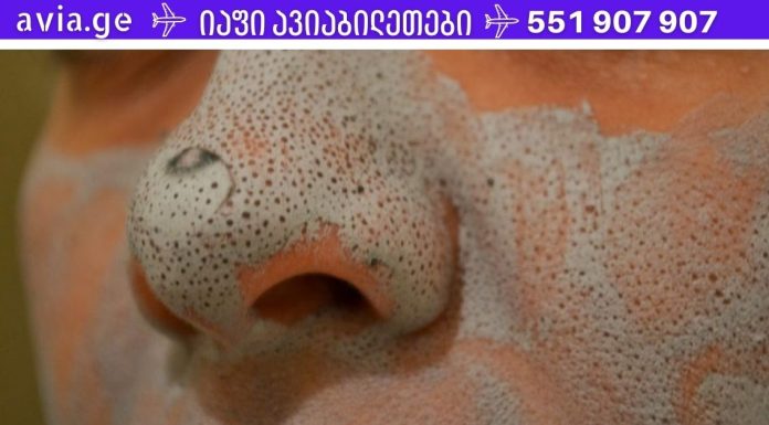 2 ინგრედიენტიანი სახის ნიღაბი ცხვირზე შავი წერტილების მოსაშორებლად. უმრტივესია!