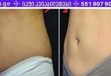 7 დღე – 7 ჭიქა! ამ წვენზე დაფუძნებული საოცარი ტექნიკა ეფექტურად მოგიხსნით მუცლის ცხიმს ! შედეგები შოკისმომგვრელია.