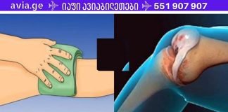 სამუდამოდ მოიშორეთ ტკივილი მუხლებსა და სახსრებში. ყველაფერი რაც თქვენ უნდა გააკეთოთ არის მუხლები ამით შემოიხვიოთ!