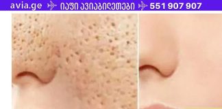 3 დღე და ყველა ღია ფორები სამუდამოდ გაქრება თქვენი კანიდან!