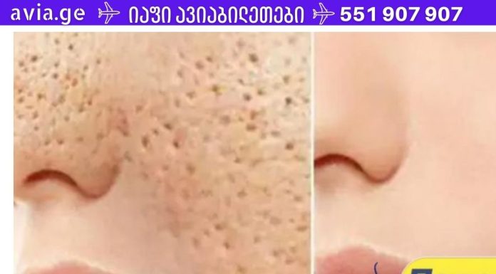 3 დღე და ყველა ღია ფორები სამუდამოდ გაქრება თქვენი კანიდან!