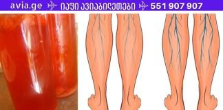 გააუმჯობესე სისხლის მიმოქცევა და კარგად იარეთ ვარიკოზული ვენების დროსაც!! უბრალოდ დალიეთ 1 ჭიქა ამ სასმელიდან დღეში!