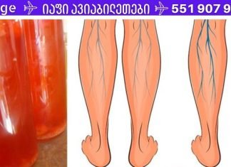 გააუმჯობესე სისხლის მიმოქცევა და კარგად იარეთ ვარიკოზული ვენების დროსაც!! უბრალოდ დალიეთ 1 ჭიქა ამ სასმელიდან დღეში!