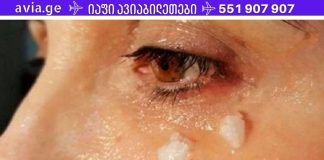 იცით, რა ხდება თვალის ირგვლივ ქოქოსის ზეთის წასმიდან 5 წუთის შემდეგ?
