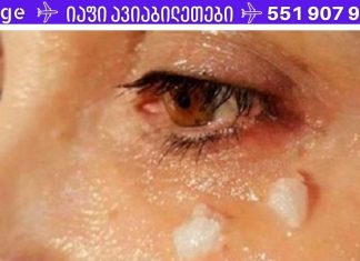 იცით, რა ხდება თვალის ირგვლივ ქოქოსის ზეთის წასმიდან 5 წუთის შემდეგ?