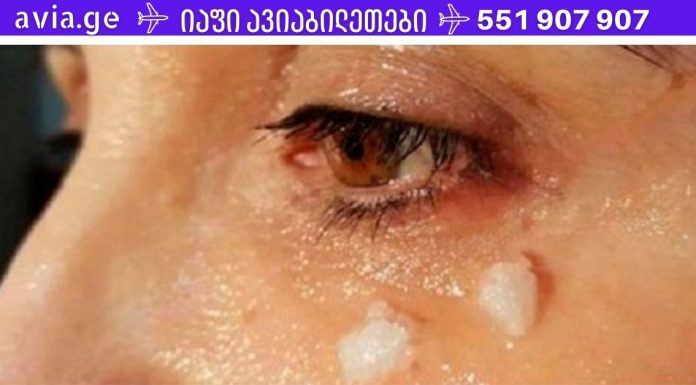 იცით, რა ხდება თვალის ირგვლივ ქოქოსის ზეთის წასმიდან 5 წუთის შემდეგ?