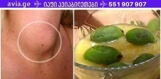 სამწუხაროდ,ექიმები ამაზე არასოდეს საუბრობენ,ფარისებრი ჯირკვლის განკურნება უმარტივესად.