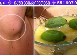 სამწუხაროდ,ექიმები ამაზე არასოდეს საუბრობენ,ფარისებრი ჯირკვლის განკურნება უმარტივესად.