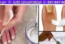 სოკოს ფრჩხილიდან დიდხანს ვერ მოვიშორე, სანამ ეს არ გავაკეთე. შედეგმა ძალიან გამახარა!