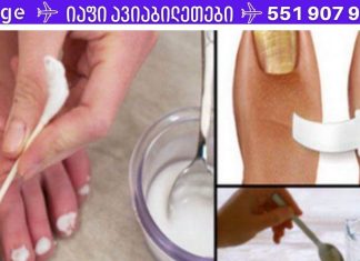 სოკოს ფრჩხილიდან დიდხანს ვერ მოვიშორე, სანამ ეს არ გავაკეთე. შედეგმა ძალიან გამახარა!