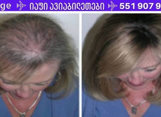 ეს ზეთი საოცარია თმის, წამწამების და წარბების ზრდისთვის.