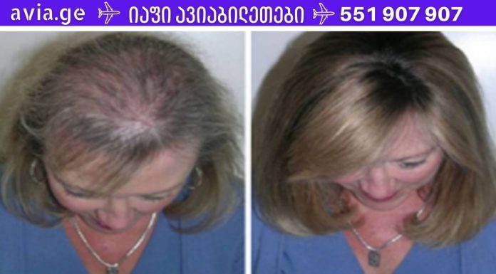 ეს ზეთი საოცარია თმის, წამწამების და წარბების ზრდისთვის.