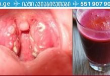 ანგინის მკურნალობა მხოლოდ ერთ დღეში, ანტიბიოტიკების გარეშე!