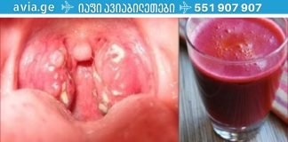 ანგინის მკურნალობა მხოლოდ ერთ დღეში, ანტიბიოტიკების გარეშე!