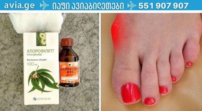 ძვალი აღარ მტკივა! მე დავხარჯე მცირე თანხა 2 პროდუქტზე და ეფექტი წარმოუდგენელია