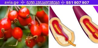 ჰიპერტენზია! იმისათვის, რომ თავში ანევრიზმა(სისხლძარღვები) არ გასკდეს და წნევა იყოს 120/80, აიღეთ ეს ბუნებრივი საშუალება.