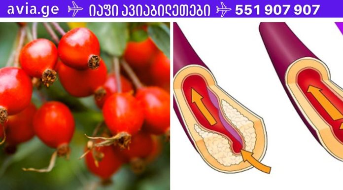 ჰიპერტენზია! იმისათვის, რომ თავში ანევრიზმა(სისხლძარღვები) არ გასკდეს და წნევა იყოს 120/80, აიღეთ ეს ბუნებრივი საშუალება.