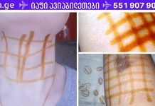 წაისვით იოდის ბადე და გათავისუფლდებით 20 დაავადებისგან! შეიტყვეთ მარტივი ხაზების სამკურნალო ძალის შესახებ!