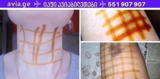 წაისვით იოდის ბადე და გათავისუფლდებით 20 დაავადებისგან! შეიტყვეთ მარტივი ხაზების სამკურნალო ძალის შესახებ!