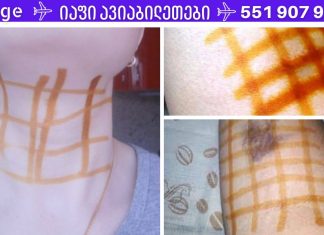 წაისვით იოდის ბადე და გათავისუფლდებით 20 დაავადებისგან! შეიტყვეთ მარტივი ხაზების სამკურნალო ძალის შესახებ!