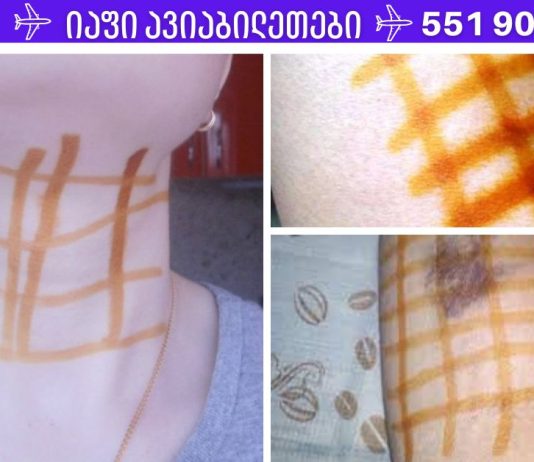 წაისვით იოდის ბადე და გათავისუფლდებით 20 დაავადებისგან! შეიტყვეთ მარტივი ხაზების სამკურნალო ძალის შესახებ!