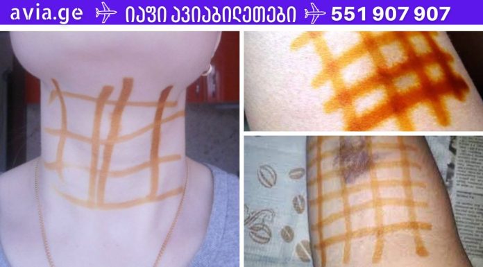 წაისვით იოდის ბადე და გათავისუფლდებით 20 დაავადებისგან! შეიტყვეთ მარტივი ხაზების სამკურნალო ძალის შესახებ!