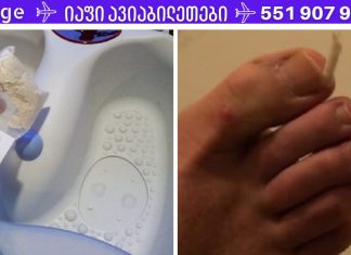 ბაბუის რჩევა ჩაზრდილი ფრჩხილის სამკურნალოდ. ერთხელ და სამუდამოდ მოიშორეთ ეს პრობლემა!