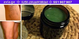 ექიმები გაოგნებულები არიან! აი, როგორ ვუმკურნალოთ ვარიკოზულ ვენებს იაფად.