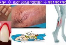 როგორ უნდა მიხვდეთ რომ სხეულს რომელიმე ვიტამინი აკლია? 10 მნიშვნელოვანი ნიშანი, რომელსაც არ შეიძლება უგულებელყო!