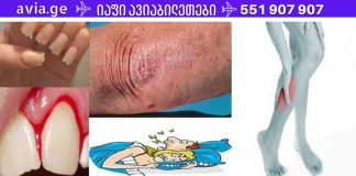 როგორ უნდა მიხვდეთ რომ სხეულს რომელიმე ვიტამინი აკლია? 10 მნიშვნელოვანი ნიშანი, რომელსაც არ შეიძლება უგულებელყო!