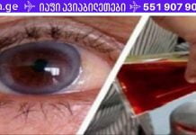 დროა გადააგდოთ ჭიქები! ეს ტექნიკა მხედველობას 97%-ით გააუმჯობესებს.