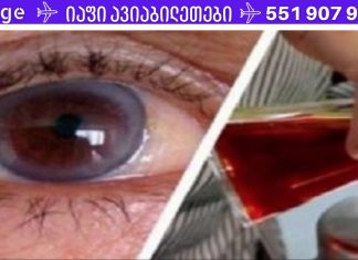 დროა გადააგდოთ ჭიქები! ეს ტექნიკა მხედველობას 97%-ით გააუმჯობესებს.