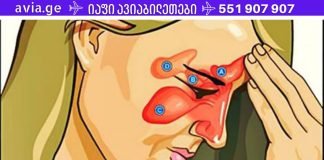 სინუსიტის 4 ძლიერი საშუალება + მარტივი ხრიკი, რომელიც სულ რაღაც 20 წამში გაგისუფთავებთ სინუსებს, ნახეთ!