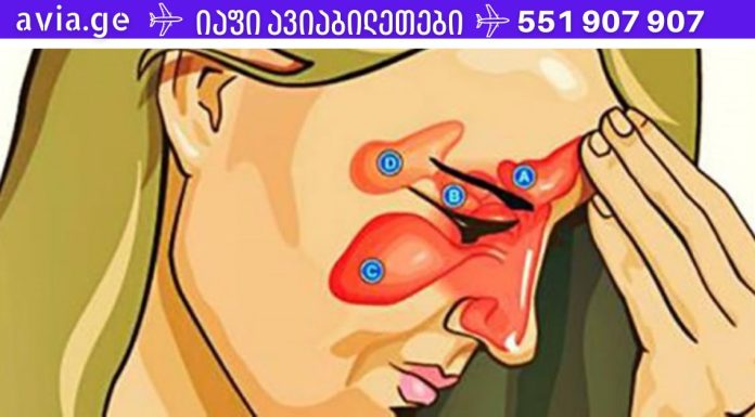 სინუსიტის 4 ძლიერი საშუალება + მარტივი ხრიკი, რომელიც სულ რაღაც 20 წამში გაგისუფთავებთ სინუსებს, ნახეთ!