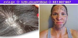 ეს აბები არის ყველა პირველადი დახმარების ნაკრები და ისინი შესანიშნავია აკნეს ,ქერტლის და უამრავი დაავადების სამკურნალოდ.