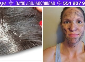 ეს აბები არის ყველა პირველადი დახმარების ნაკრები და ისინი შესანიშნავია აკნეს ,ქერტლის და უამრავი დაავადების სამკურნალოდ.