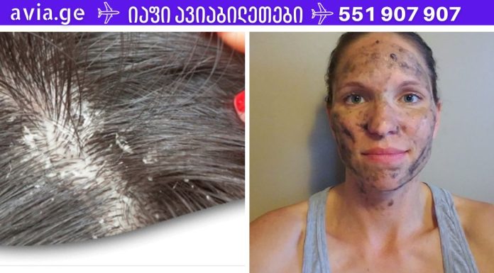 ეს აბები არის ყველა პირველადი დახმარების ნაკრები და ისინი შესანიშნავია აკნეს ,ქერტლის და უამრავი დაავადების სამკურნალოდ.