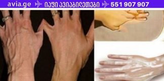 ცივ ამინდებში ყოველთვის მაწუხებს ეს პრობლემა.უმარტივესით რეცეპტით დაირბილეთ ხელები და გახადეთ ხავერდოვანი.