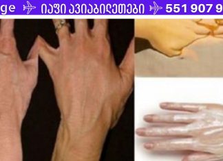 ცივ ამინდებში ყოველთვის მაწუხებს ეს პრობლემა.უმარტივესით რეცეპტით დაირბილეთ ხელები და გახადეთ ხავერდოვანი.