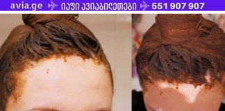 მაშინაც კი, თუ წამლები უძლურია, ეს ხალხური საშუალება ხელს შეუწყობს თმის ცვენის შეჩერებას!