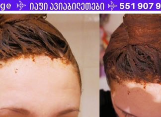 მაშინაც კი, თუ წამლები უძლურია, ეს ხალხური საშუალება ხელს შეუწყობს თმის ცვენის შეჩერებას!