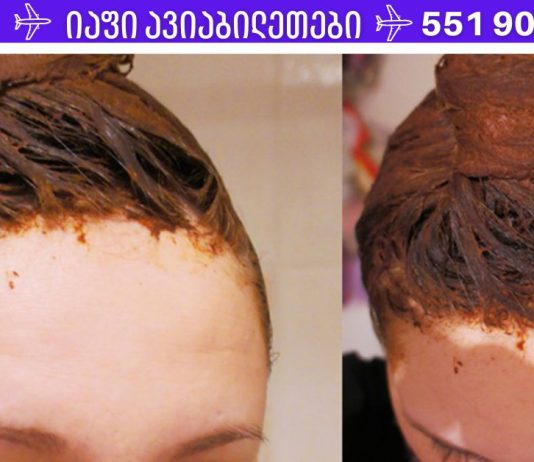მაშინაც კი, თუ წამლები უძლურია, ეს ხალხური საშუალება ხელს შეუწყობს თმის ცვენის შეჩერებას!
